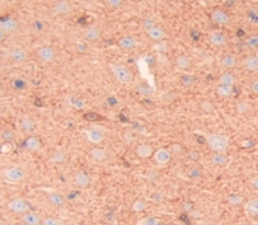 Polyclonal Antibody to Cluster Of Differentiation 2 (CD2)