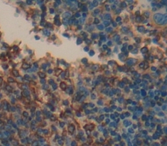 Polyclonal Antibody to Cluster Of Differentiation 23 (CD23)