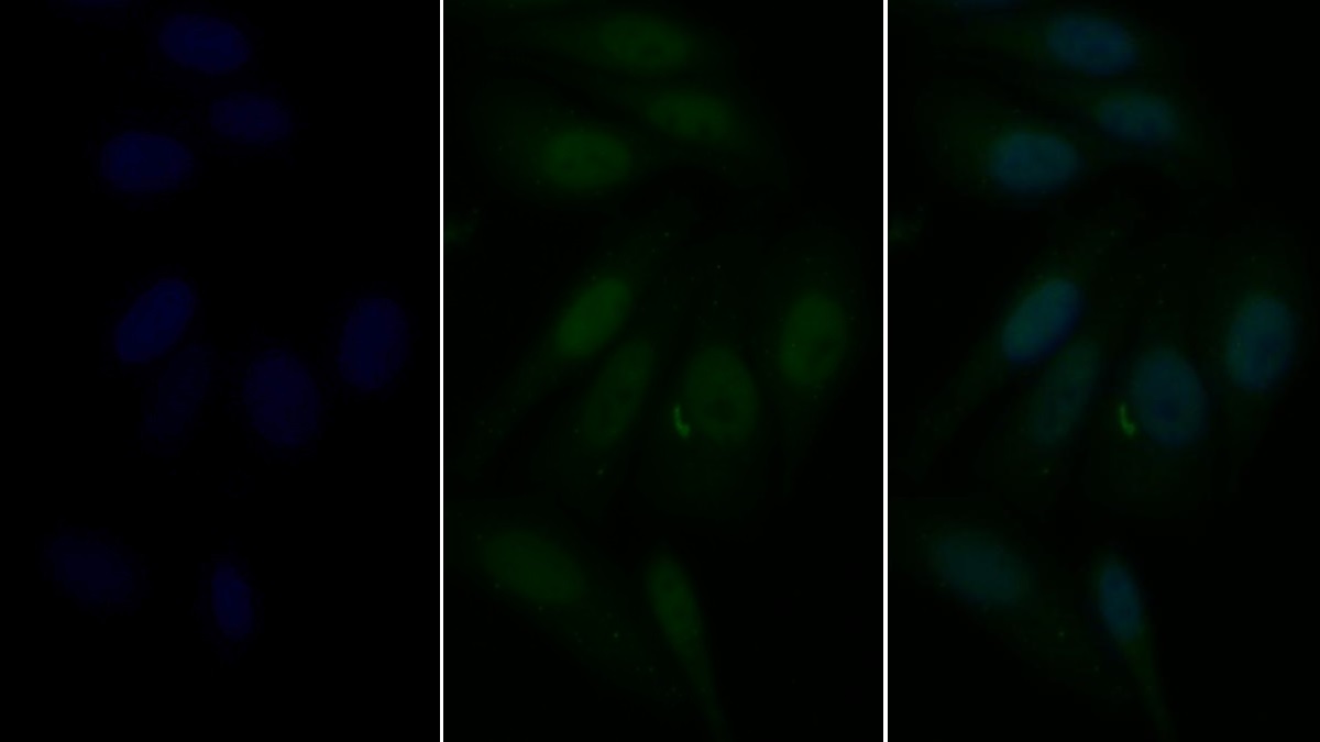 Polyclonal Antibody to Interferon Regulatory Factor 5 (IRF5)