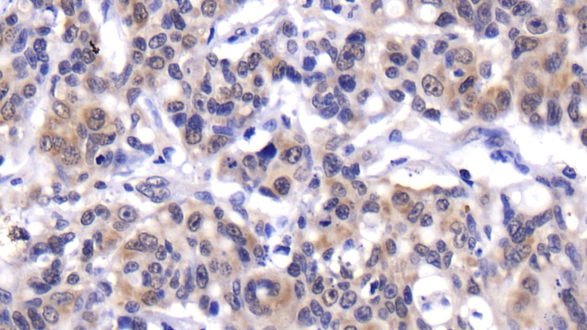 Polyclonal Antibody to B-Lymphocyte Chemoattractant (BLC)