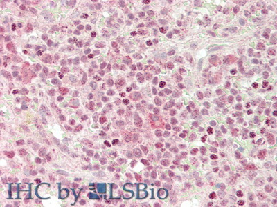 Polyclonal Antibody to Chemokine (C-X-C Motif) Ligand 2 (CXCL2)