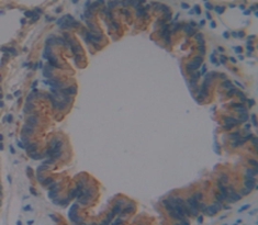 Polyclonal Antibody to Chemokine (C-X-C Motif) Ligand 2 (CXCL2)