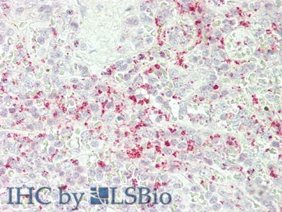 Polyclonal Antibody to Chemokine (C-X-C Motif) Ligand 3 (CXCL3)