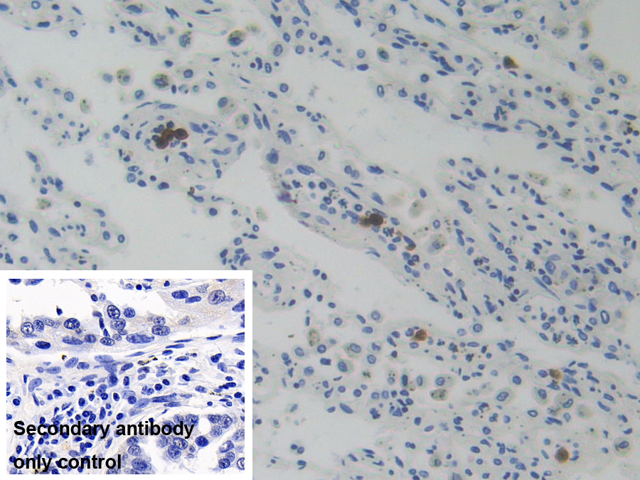 Polyclonal Antibody to Glucocorticoid Receptor (GR)