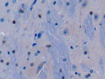 Polyclonal Antibody to Glucocorticoid Receptor (GR)