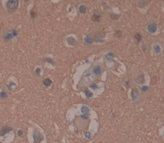 Polyclonal Antibody to Chorionic Gonadotropin Alpha Polypeptide (CGa)