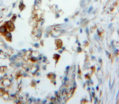 Polyclonal Antibody to Surfactant Protein C (SP-C)