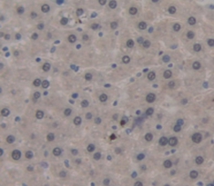 Polyclonal Antibody to Surfactant Protein C (SP-C)