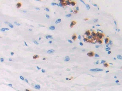 Polyclonal Antibody to Prostaglandin D2 Synthase (PTGDS)