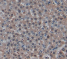 Polyclonal Antibody to Major Basic Protein (MBP)