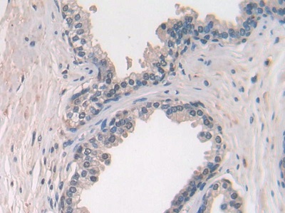 Polyclonal Antibody to Chemokine (C-X-C Motif) Ligand 27 (CCL27)