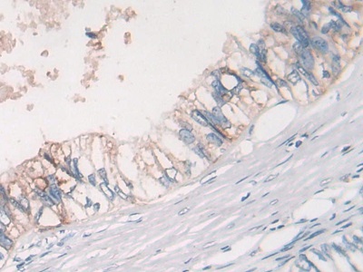 Polyclonal Antibody to Myostatin (MSTN)