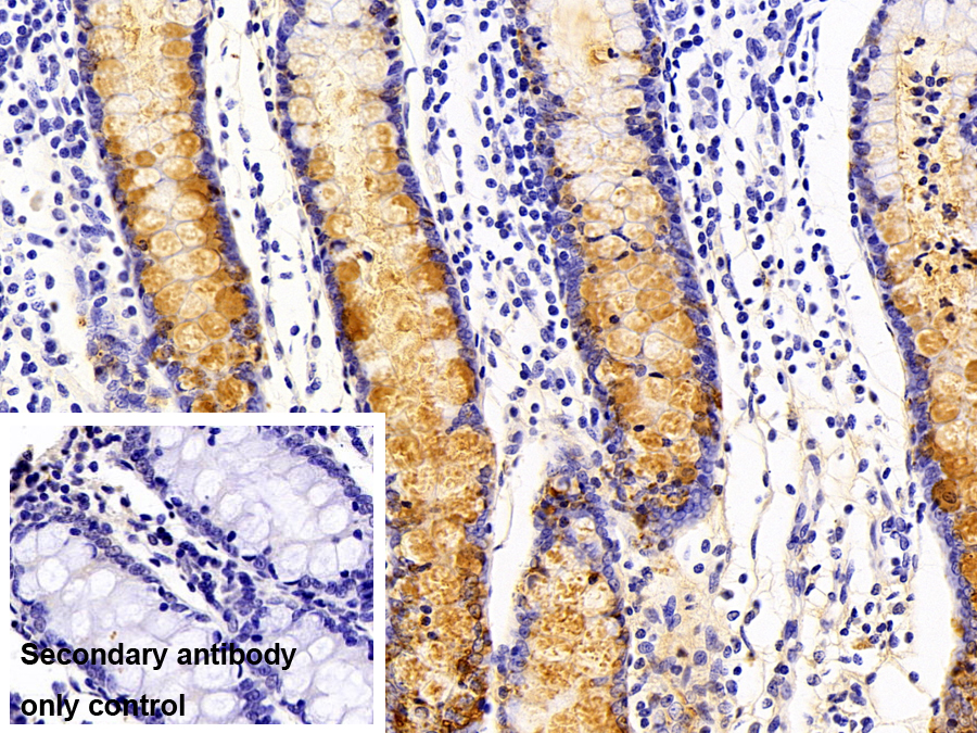 Polyclonal Antibody to Trefoil Factor 3 (TFF3)