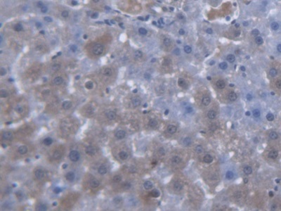 Polyclonal Antibody to Solute Carrier Family 25 Member 20 (SLC25A20)