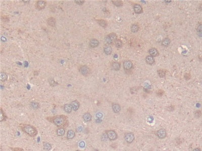 Polyclonal Antibody to Citrate Synthase (CS)