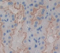 Polyclonal Antibody to Cluster Of Differentiation 146 (CD146)