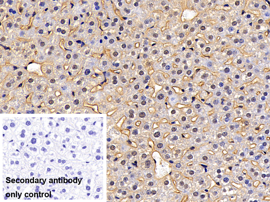 Polyclonal Antibody to Cluster Of Differentiation 146 (CD146)