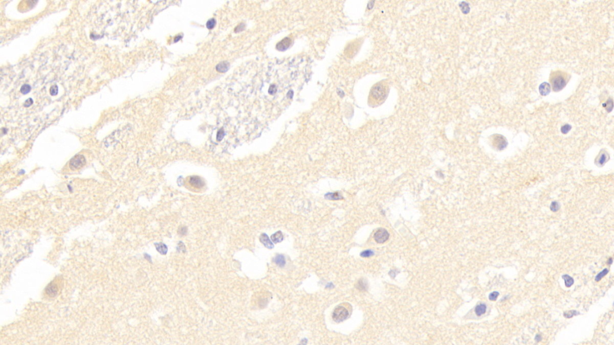 Polyclonal Antibody to Melanotransferrin (MFI2)