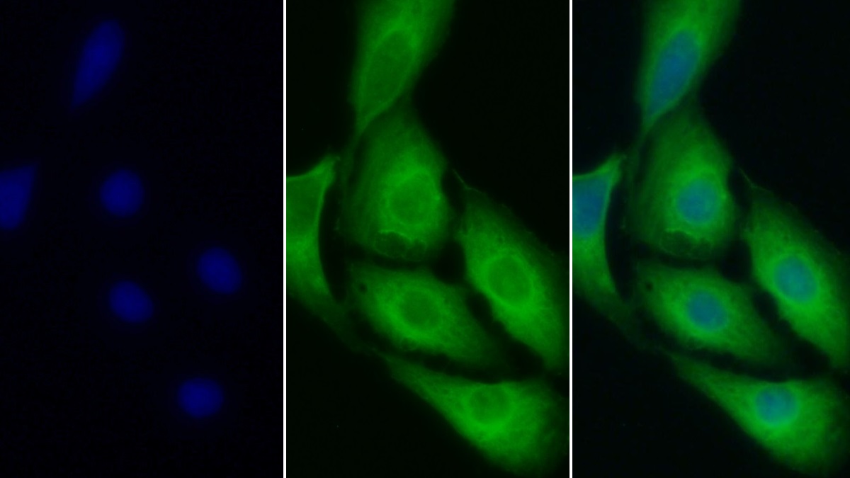 Polyclonal Antibody to Prion Protein (PRNP)