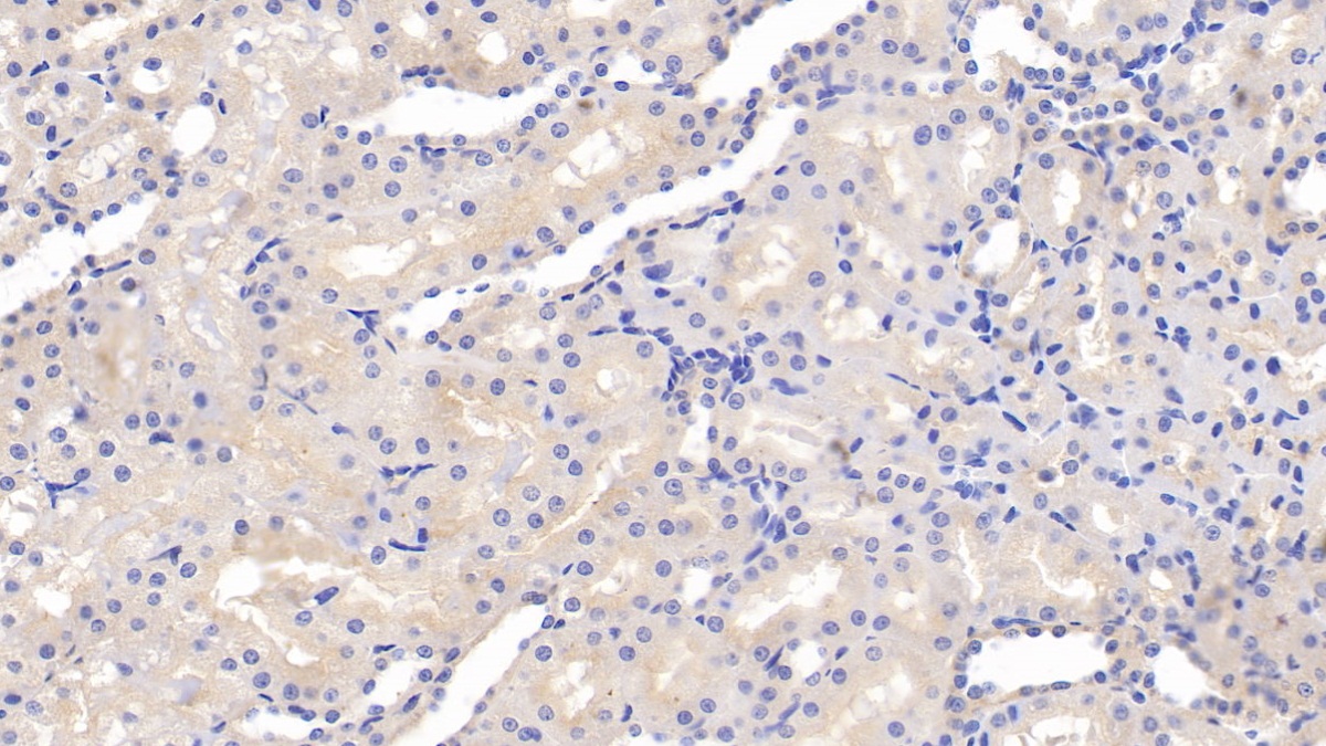 Polyclonal Antibody to Permeability Glycoprotein (Pgp)