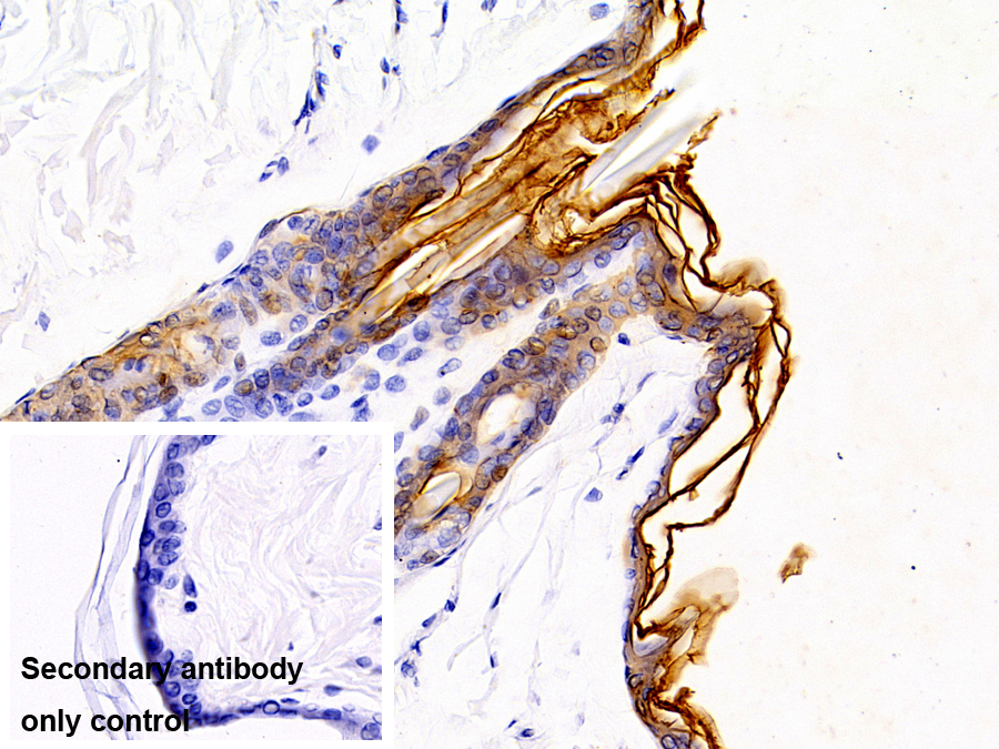 Polyclonal Antibody to Cytokeratin 10 (CK10)