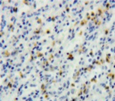 Polyclonal Antibody to T-Cell Leukemia/Lymphoma Protein 1A (TCL1A)