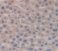 Polyclonal Antibody to T-Cell Leukemia/Lymphoma Protein 1A (TCL1A)