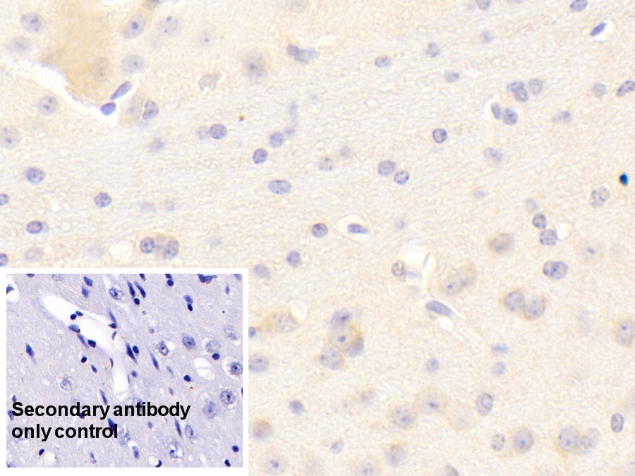 Polyclonal Antibody to Kell Protein (KEL)