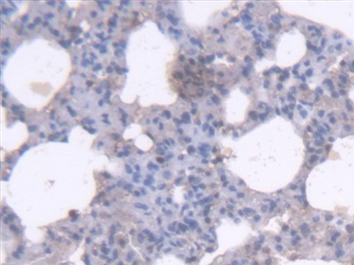 Polyclonal Antibody to Rh Associated Glycoprotein (RHAG)