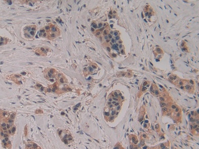 Polyclonal Antibody to Caspase 4 (CASP4)