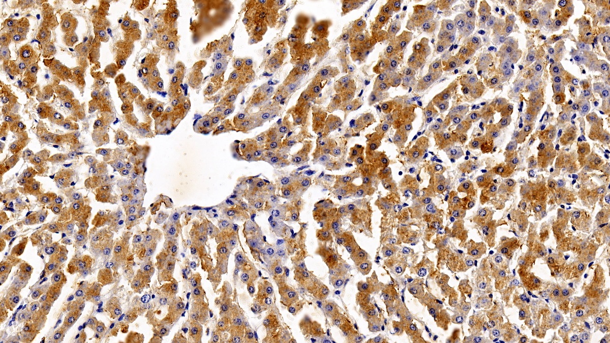 Polyclonal Antibody to Signal Transducer And Activator Of Transcription 3 (STAT3)