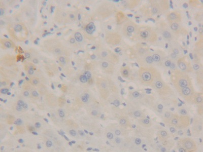 Polyclonal Antibody to Signal Transducer And Activator Of Transcription 3 (STAT3)