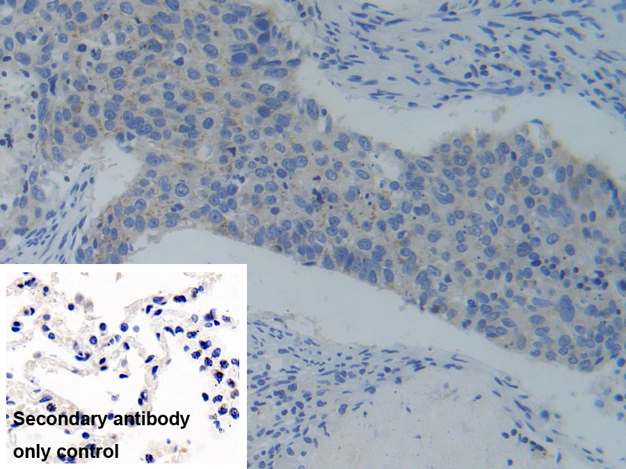 Polyclonal Antibody to Phosphofructokinase, Platelet (PFKP)