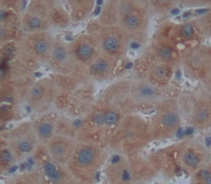 Polyclonal Antibody to Hexokinase 3, White Cell (HK3)