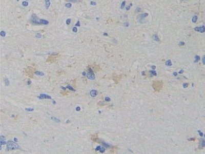 Polyclonal Antibody to Tryptophanyl tRNA Synthetase (WARS)