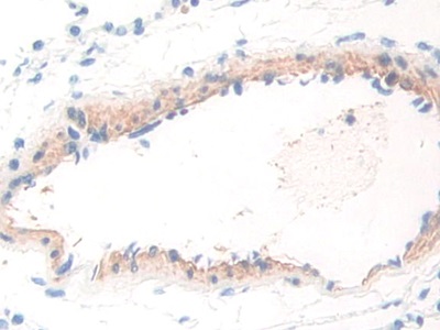 Polyclonal Antibody to Tryptophanyl tRNA Synthetase (WARS)