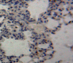 Polyclonal Antibody to Tumor Necrosis Factor Ligand Superfamily, Member 13 (TNFSF13)