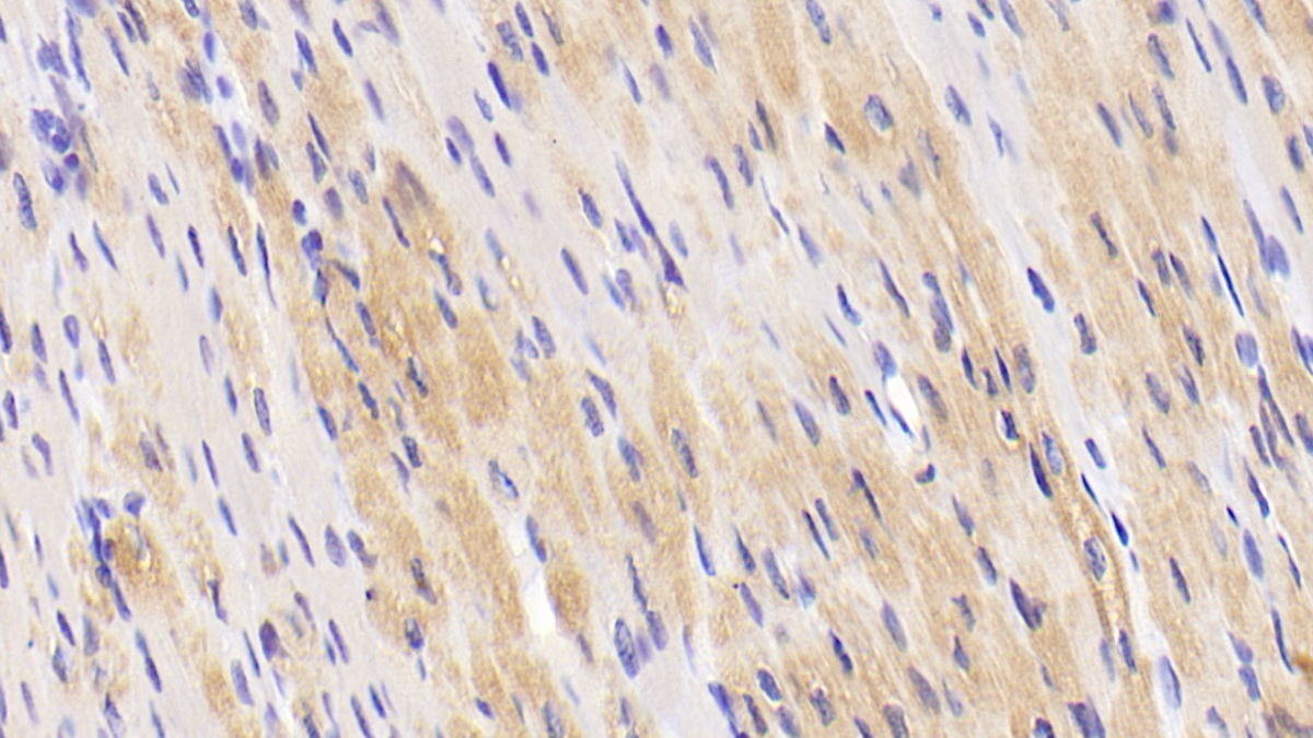 Polyclonal Antibody to Tumor Necrosis Factor Ligand Superfamily, Member 13 (TNFSF13)