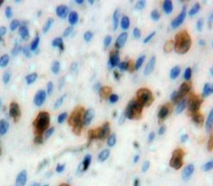 Polyclonal Antibody to Interferon Regulatory Factor 4 (IRF4)