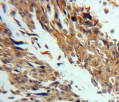 Polyclonal Antibody to Transglutaminase 3, Epidermal (TGM3)