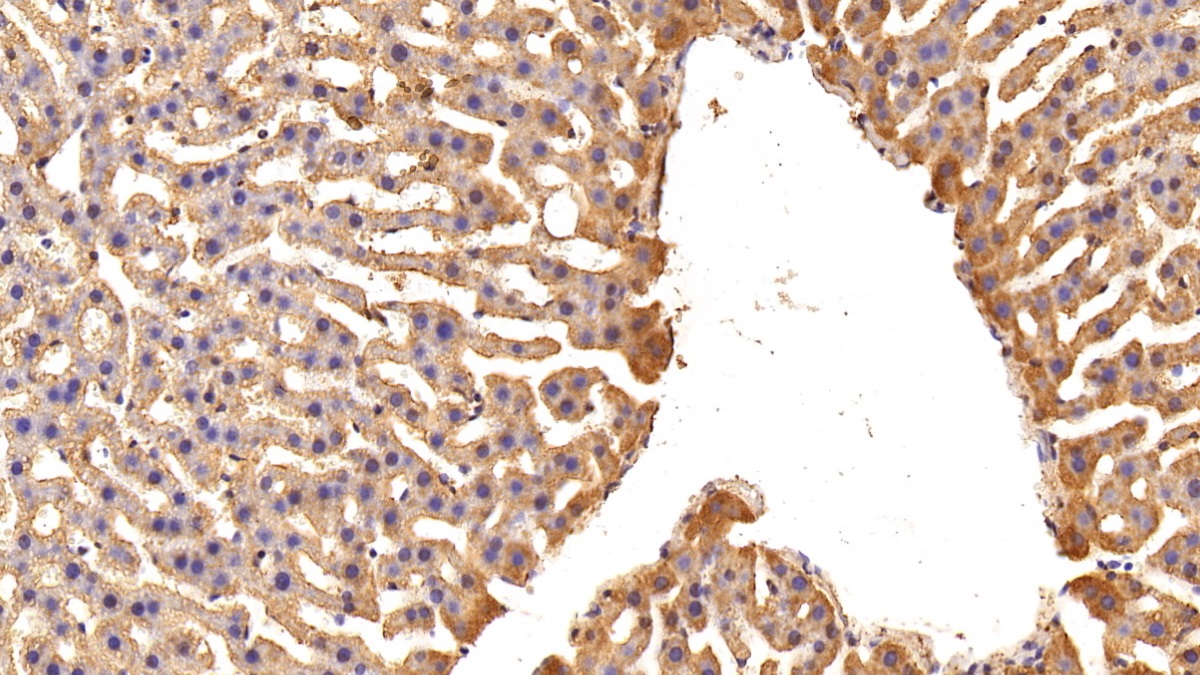 Polyclonal Antibody to Inhibin Beta B (INHbB)