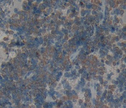 Polyclonal Antibody to Killer Cell Lectin Like Receptor Subfamily K, Member 1 (KLRK1)