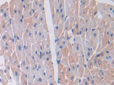 Polyclonal Antibody to Lectin Galactoside Binding, Soluble 3 Binding Protein (LGALS3BP)