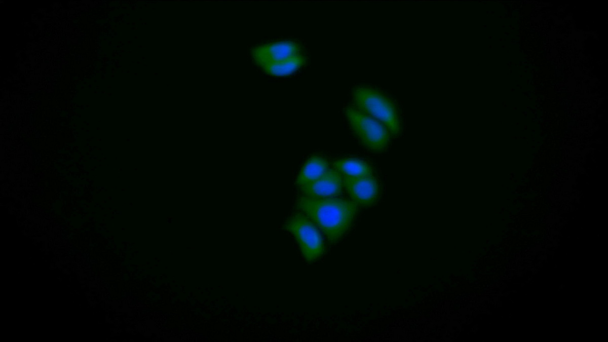 Polyclonal Antibody to S100 Calcium Binding Protein A6 (S100A6)