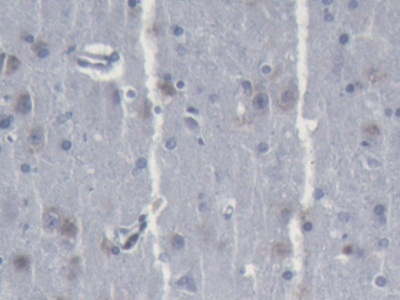 Polyclonal Antibody to Transglutaminase 1 (TGM1)