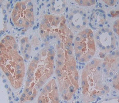 Polyclonal Antibody to Receptor Interacting Serine Threonine Kinase 2 (RIPK2)