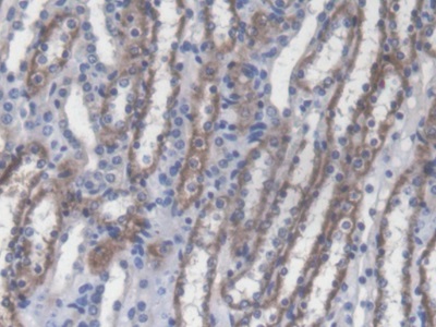 Polyclonal Antibody to Receptor Interacting Serine Threonine Kinase 2 (RIPK2)