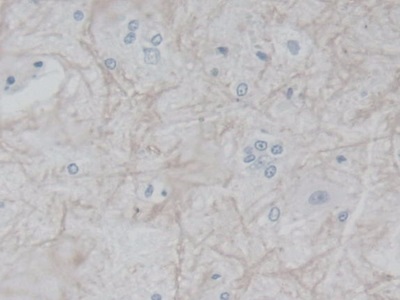 Polyclonal Antibody to Fibroblast Growth Factor Receptor 1 (FGFR1)