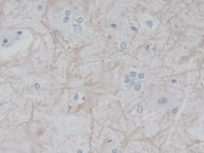 Polyclonal Antibody to Fibroblast Growth Factor Receptor 1 (FGFR1)