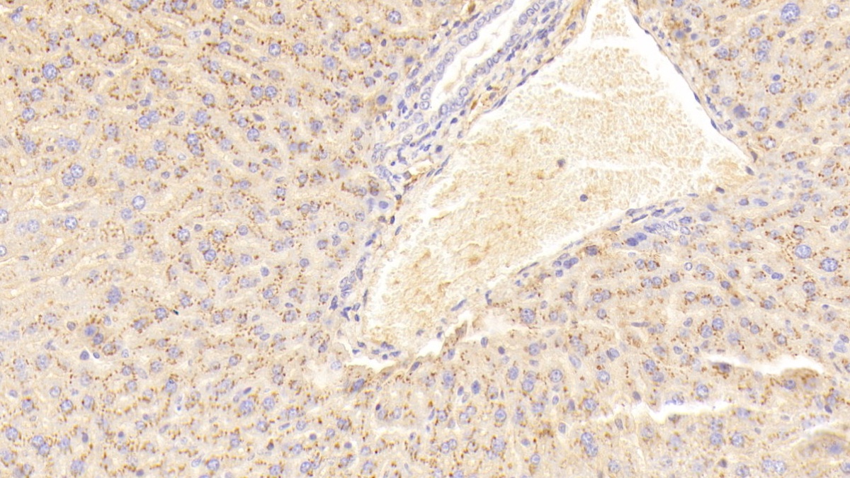 Polyclonal Antibody to Serum Amyloid A2 (SAA2)